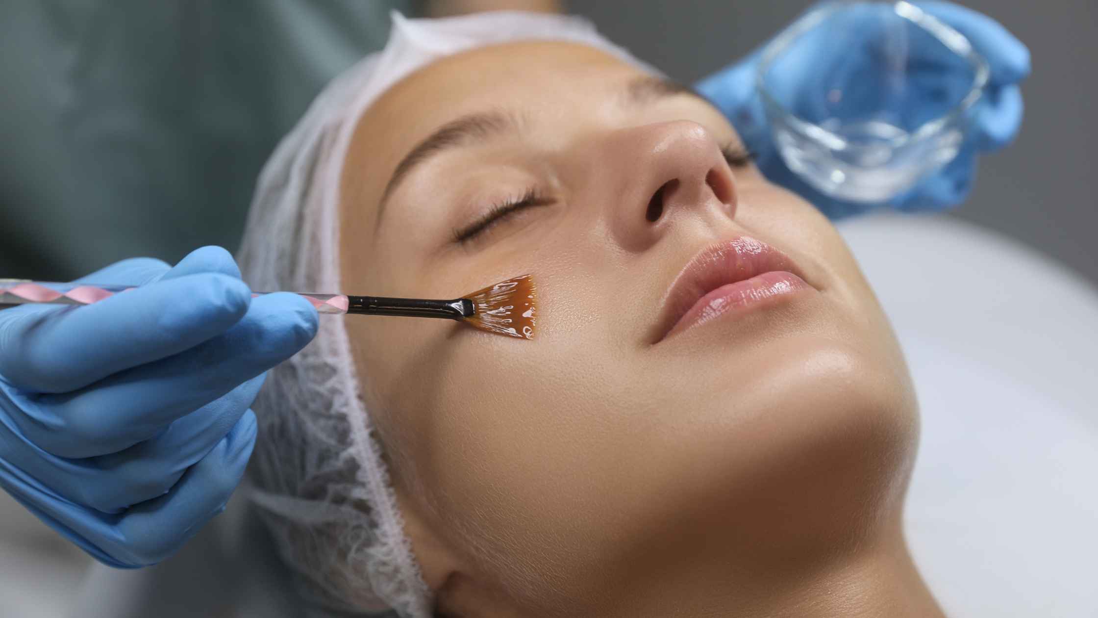 Post-Chemical Peel Care: Maximizing Your Results