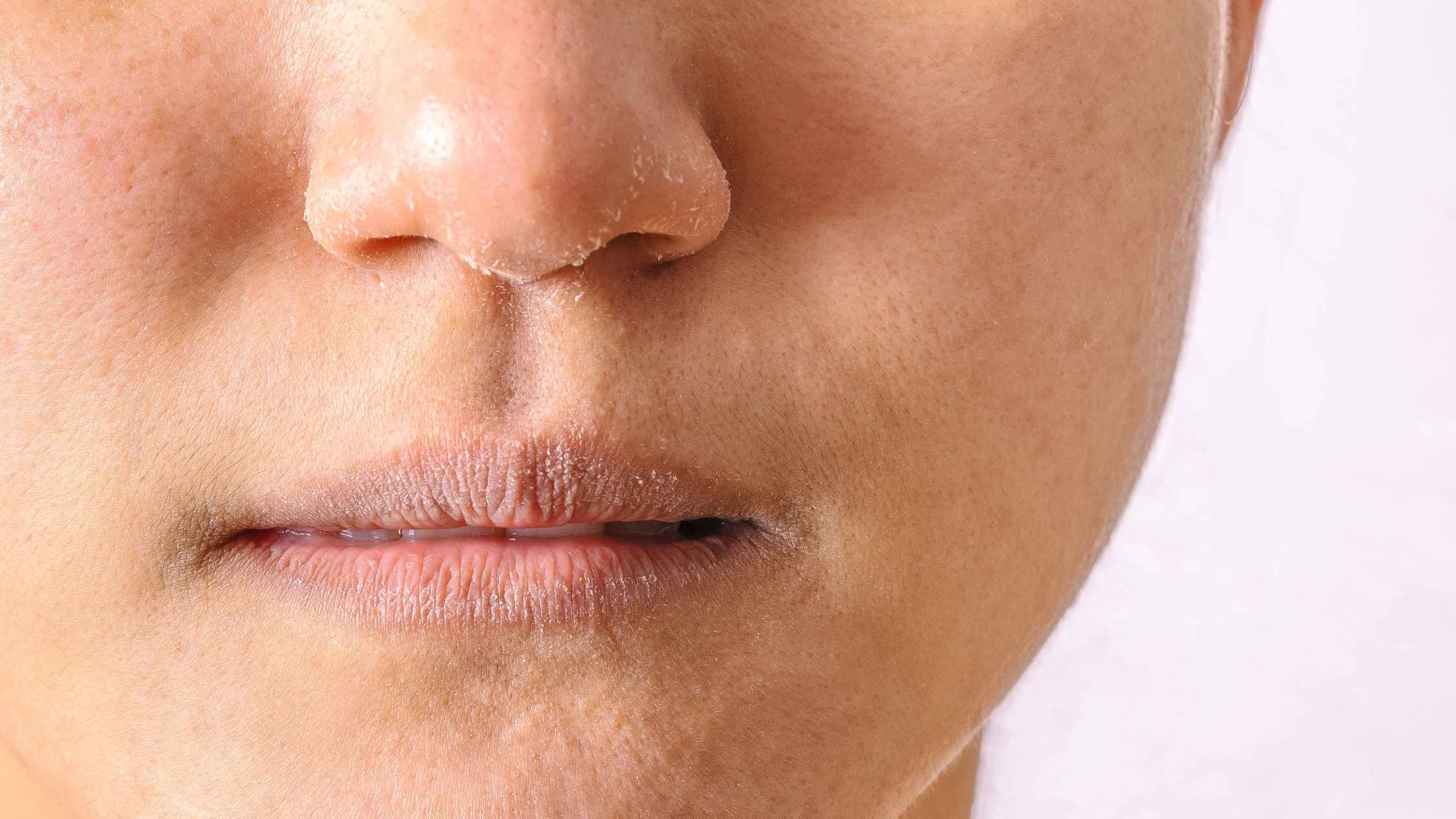 Winter Skincare: Protecting Your Skin from the Cold